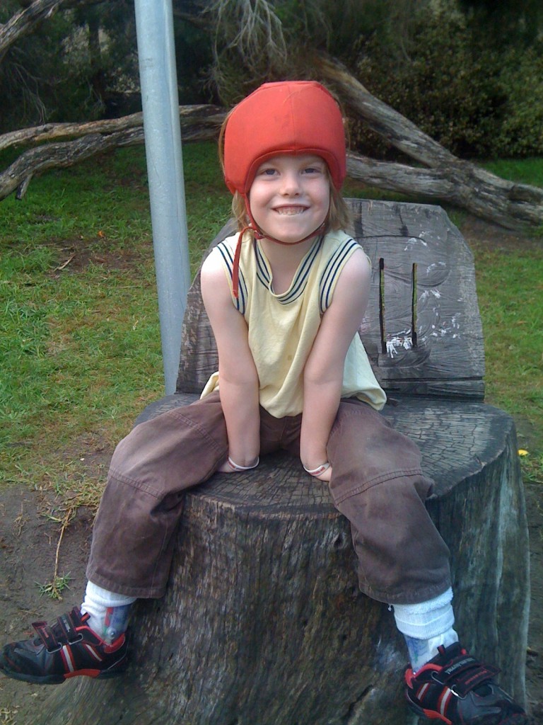Dravet's Syndrome sufferer Tara has had funding support from Australian Children's Charity I Give A Buck Foundation.